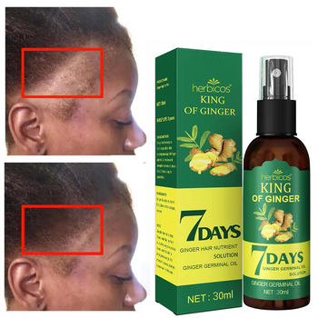 Ginger Anti Hair Loss Spray contract manufacturing