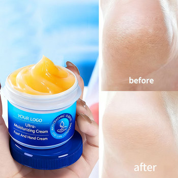 Anti dry hand and foot exfoliating shea cream
