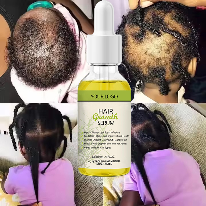 Rosemary Mint Scalp Hair Growth Oil