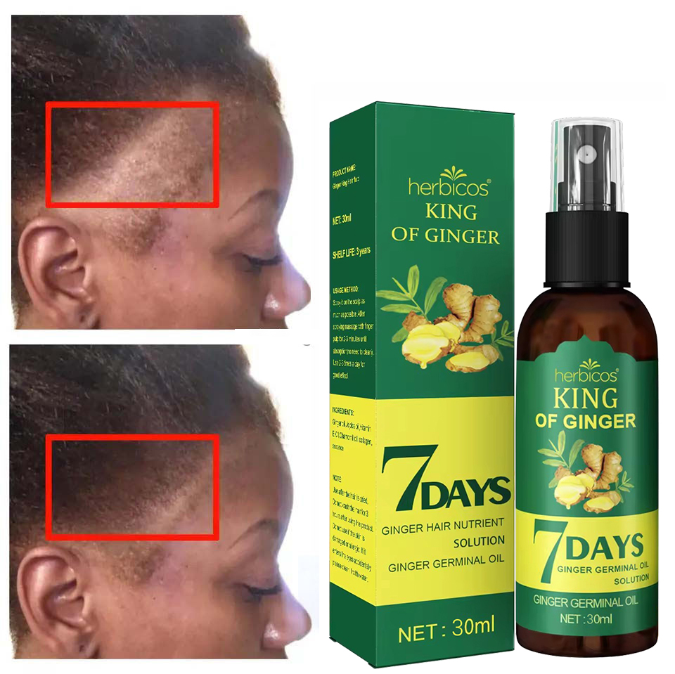 Ginger Oil